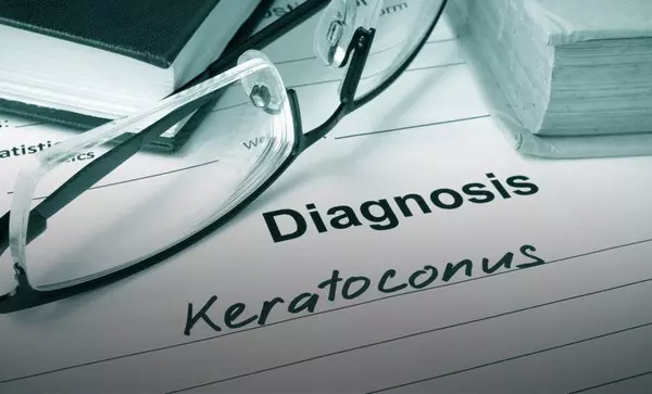 Diagnózis - keratokónusz